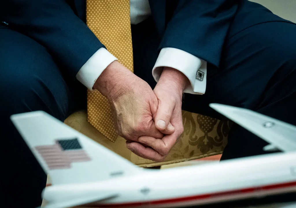 Trump Was Diagnosed With Chronic Venous Insufficiency. What Is It?
